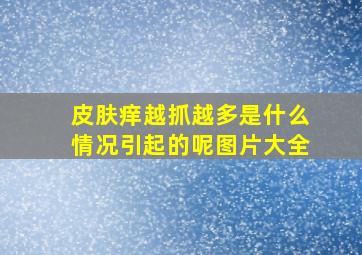 皮肤痒越抓越多是什么情况引起的呢图片大全