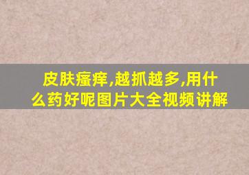 皮肤瘙痒,越抓越多,用什么药好呢图片大全视频讲解