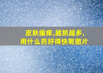 皮肤瘙痒,越抓越多,用什么药好得快呢图片