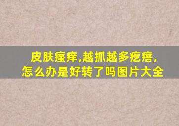 皮肤瘙痒,越抓越多疙瘩,怎么办是好转了吗图片大全