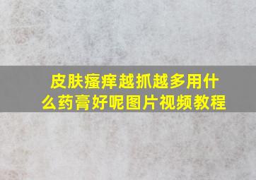 皮肤瘙痒越抓越多用什么药膏好呢图片视频教程