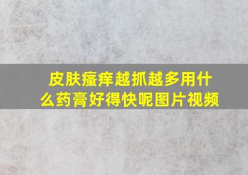 皮肤瘙痒越抓越多用什么药膏好得快呢图片视频