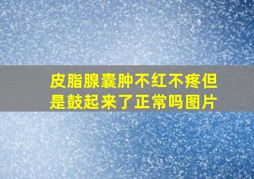 皮脂腺囊肿不红不疼但是鼓起来了正常吗图片