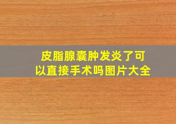 皮脂腺囊肿发炎了可以直接手术吗图片大全