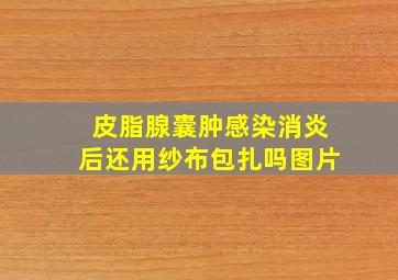 皮脂腺囊肿感染消炎后还用纱布包扎吗图片