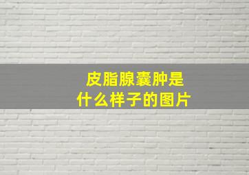 皮脂腺囊肿是什么样子的图片