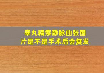 睾丸精索静脉曲张图片是不是手术后会复发