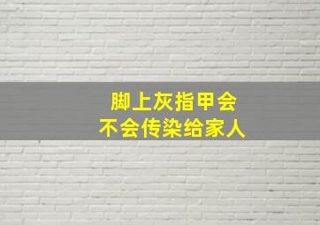 脚上灰指甲会不会传染给家人