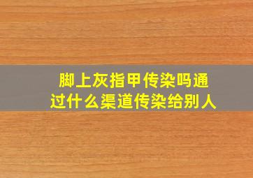 脚上灰指甲传染吗通过什么渠道传染给别人