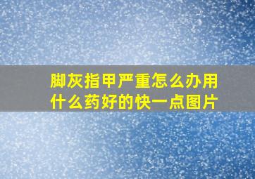 脚灰指甲严重怎么办用什么药好的快一点图片