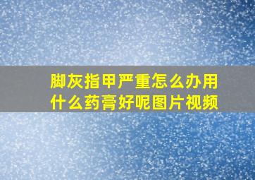 脚灰指甲严重怎么办用什么药膏好呢图片视频