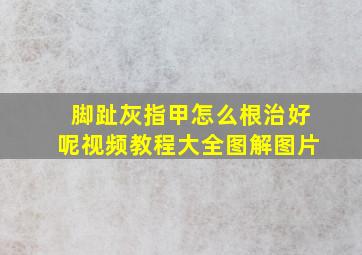 脚趾灰指甲怎么根治好呢视频教程大全图解图片