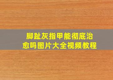 脚趾灰指甲能彻底治愈吗图片大全视频教程