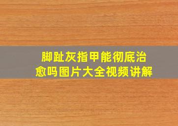 脚趾灰指甲能彻底治愈吗图片大全视频讲解