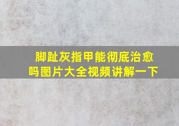 脚趾灰指甲能彻底治愈吗图片大全视频讲解一下