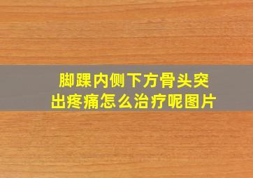 脚踝内侧下方骨头突出疼痛怎么治疗呢图片