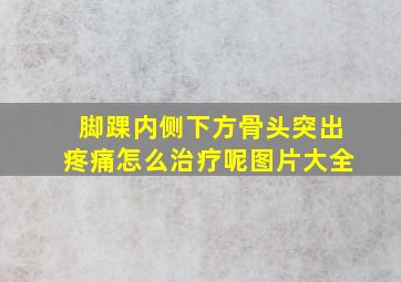 脚踝内侧下方骨头突出疼痛怎么治疗呢图片大全