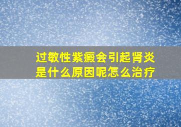 过敏性紫癜会引起肾炎是什么原因呢怎么治疗