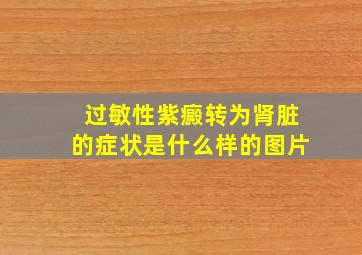 过敏性紫癜转为肾脏的症状是什么样的图片