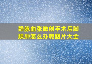 静脉曲张微创手术后脚踝肿怎么办呢图片大全