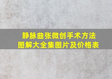 静脉曲张微创手术方法图解大全集图片及价格表