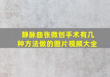 静脉曲张微创手术有几种方法做的图片视频大全