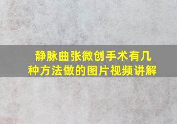 静脉曲张微创手术有几种方法做的图片视频讲解