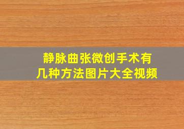 静脉曲张微创手术有几种方法图片大全视频