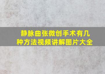 静脉曲张微创手术有几种方法视频讲解图片大全