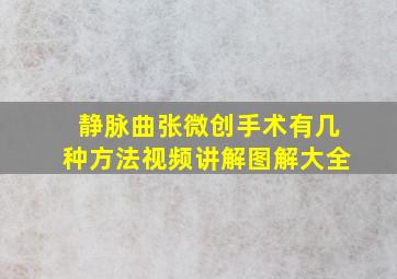 静脉曲张微创手术有几种方法视频讲解图解大全