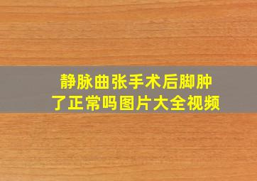 静脉曲张手术后脚肿了正常吗图片大全视频