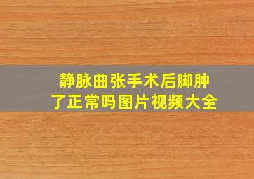 静脉曲张手术后脚肿了正常吗图片视频大全