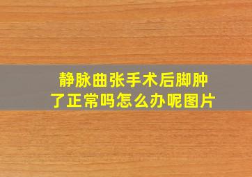 静脉曲张手术后脚肿了正常吗怎么办呢图片