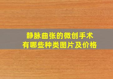 静脉曲张的微创手术有哪些种类图片及价格