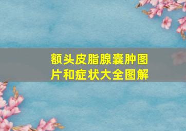 额头皮脂腺囊肿图片和症状大全图解