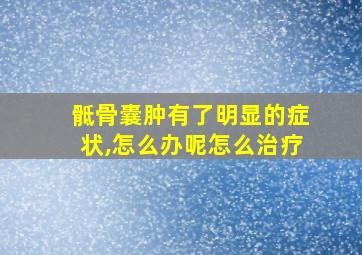 骶骨囊肿有了明显的症状,怎么办呢怎么治疗